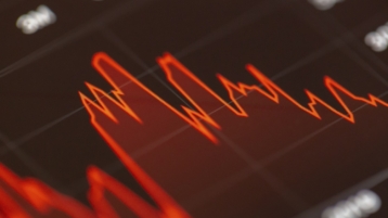 Gaan de aandelenbeurzen nu definitief omhoog of omlaag?